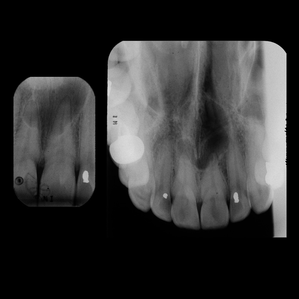 image 3a